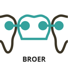 Broer