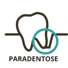 Paradentose